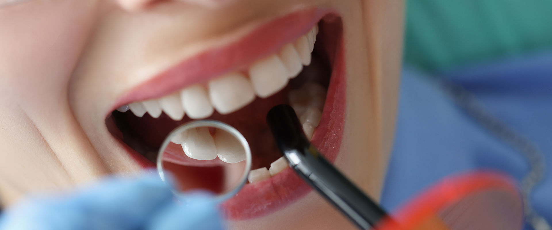 General Dentistry Treatments 